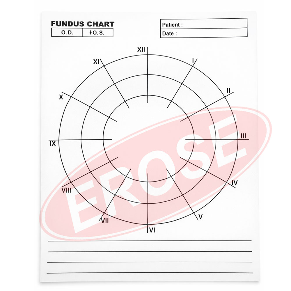 Fundus chart