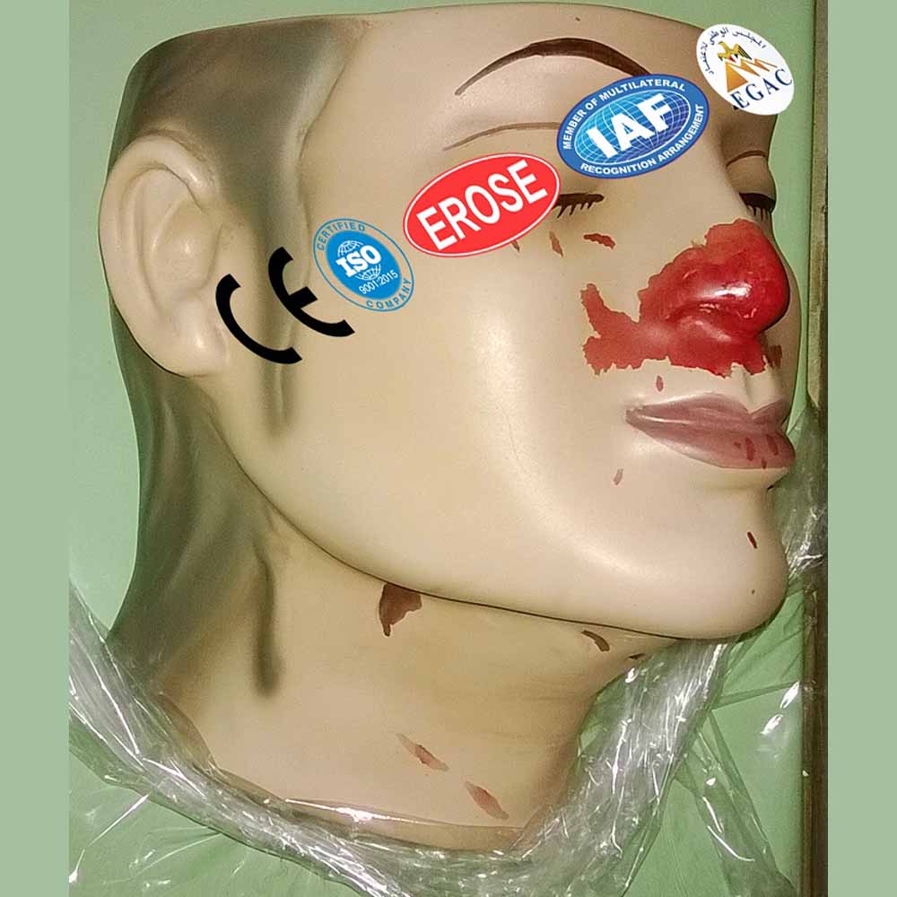 Crescentic Abrasions Throttling, Forensic Model