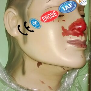 Crescentic Abrasions Throttling, Forensic Model