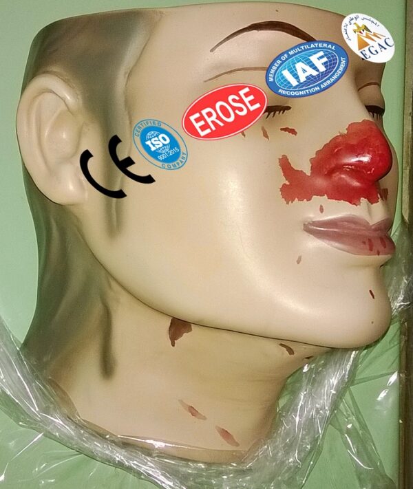 Crescentic Abrasions Throttling, Forensic Model