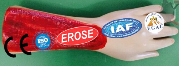 Electric Burn In Arm, Forensic Model