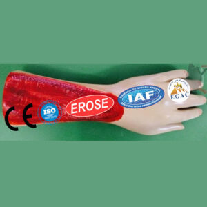 Electric Burn In Arm, Forensic Model