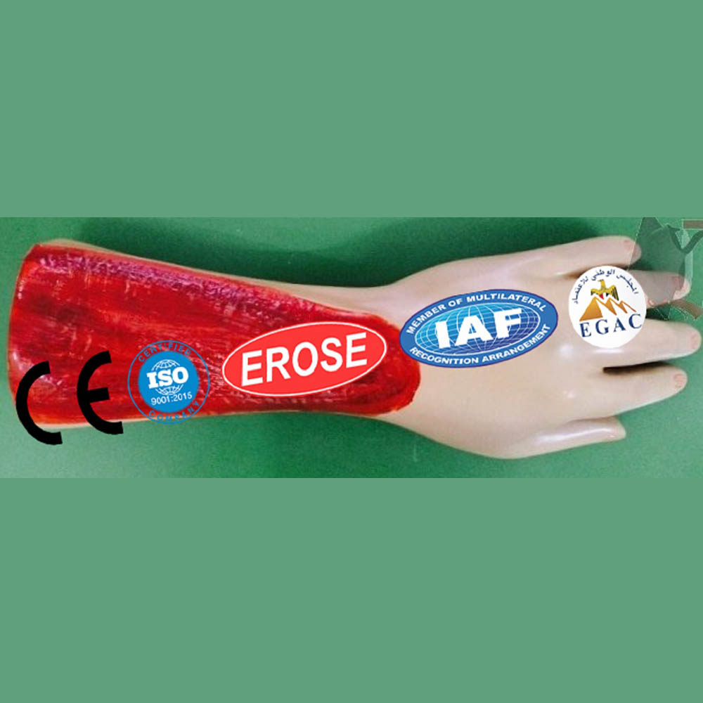 Electric Burn In Arm, Forensic Model