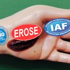 Electric Injury In Hand, Forensic Model