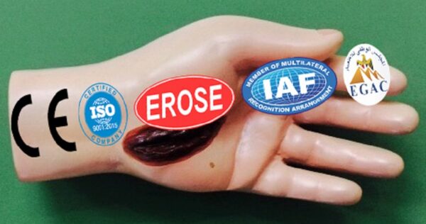Electric Injury In Hand, Forensic Model