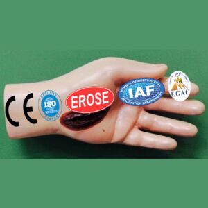Electric Injury In Hand, Forensic Model
