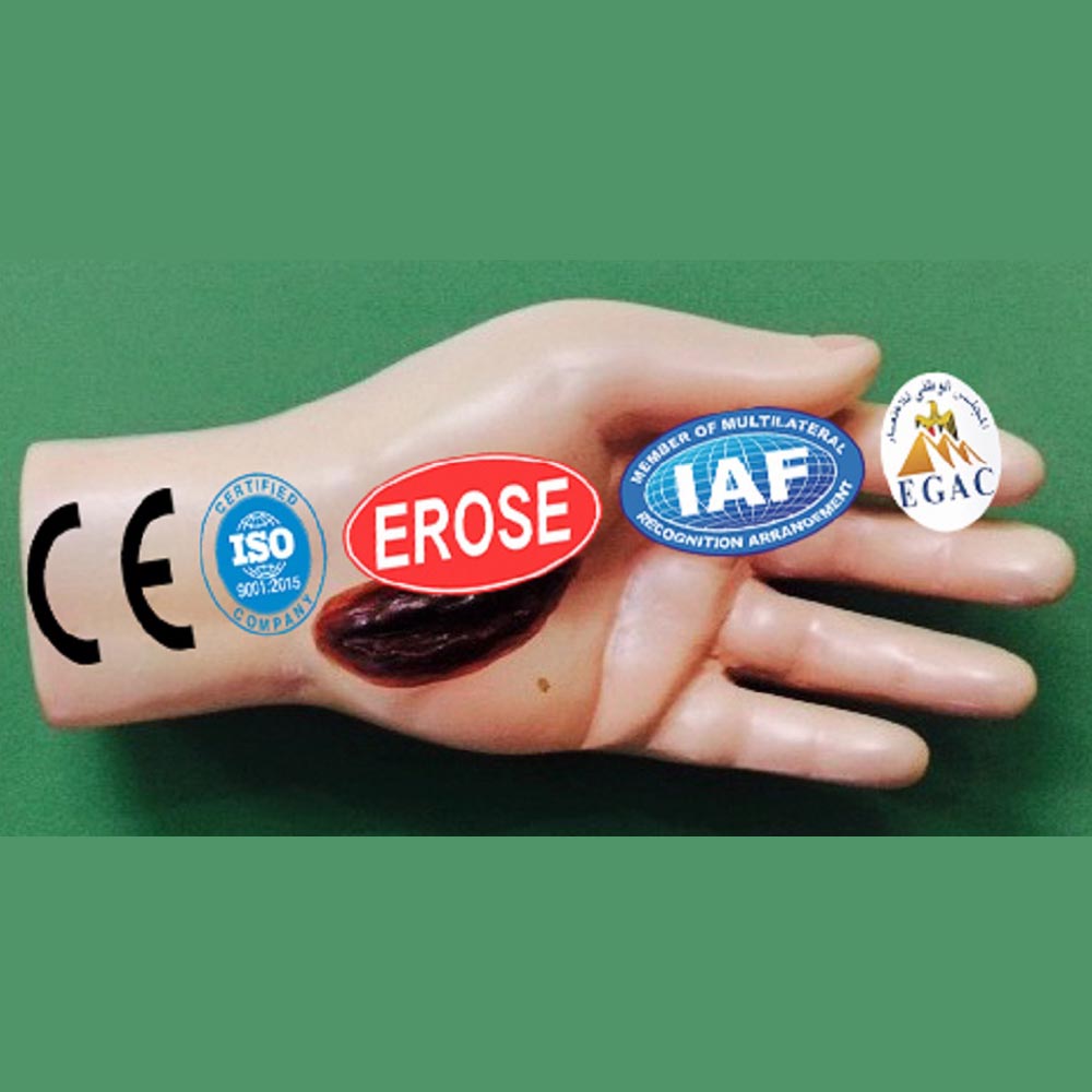 Electric Injury In Hand, Forensic Model