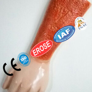 Fix Arm Injury, Forensic Model