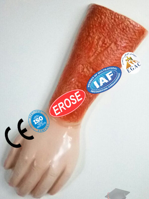 Fix Arm Injury, Forensic Model