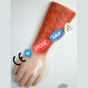 Fix Arm Injury, Forensic Model