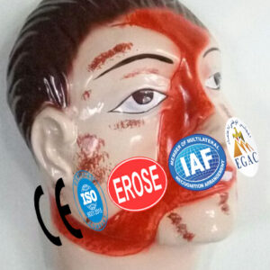 Road Accident, Forensic Model