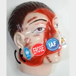 Road Accident, Forensic Model