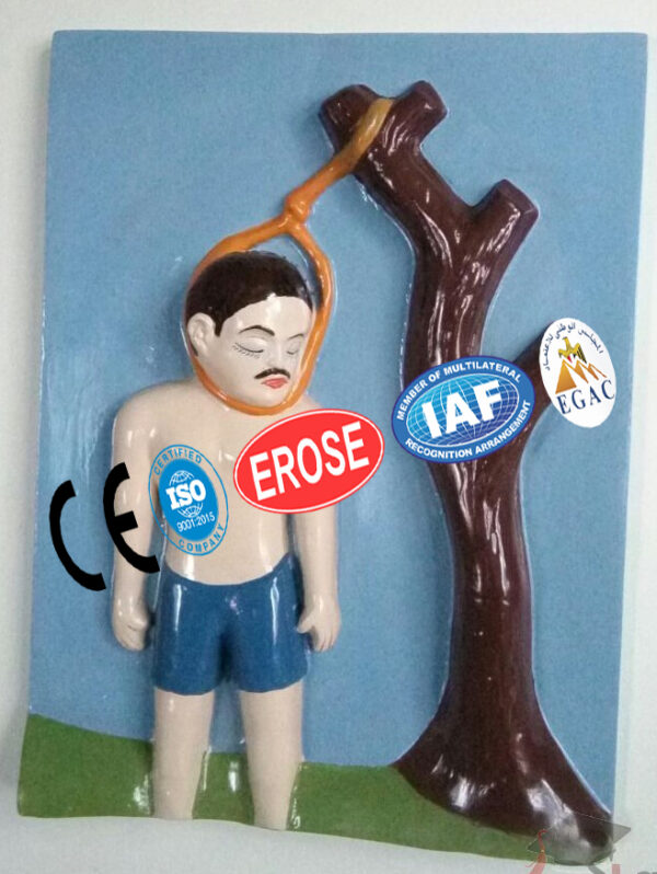 Suicidal Hanging, Forensic Model