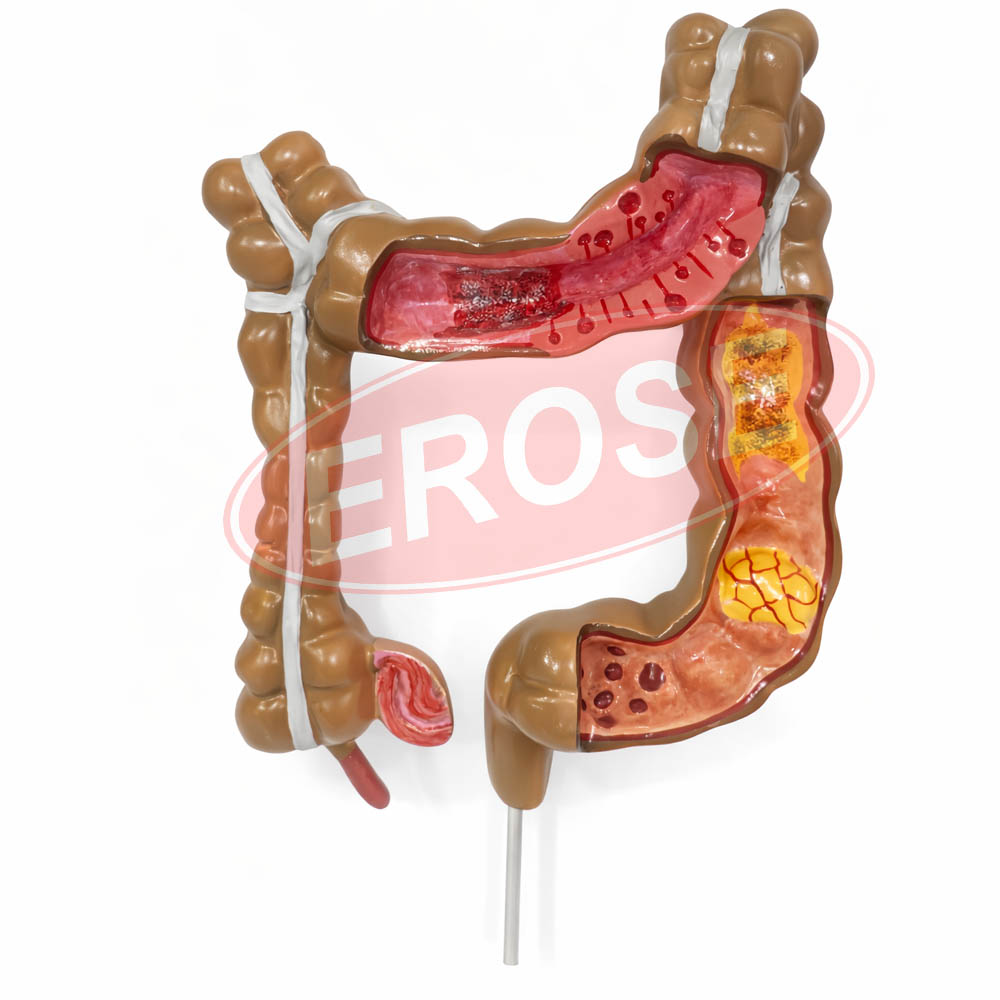 Human Colon Intestine Model