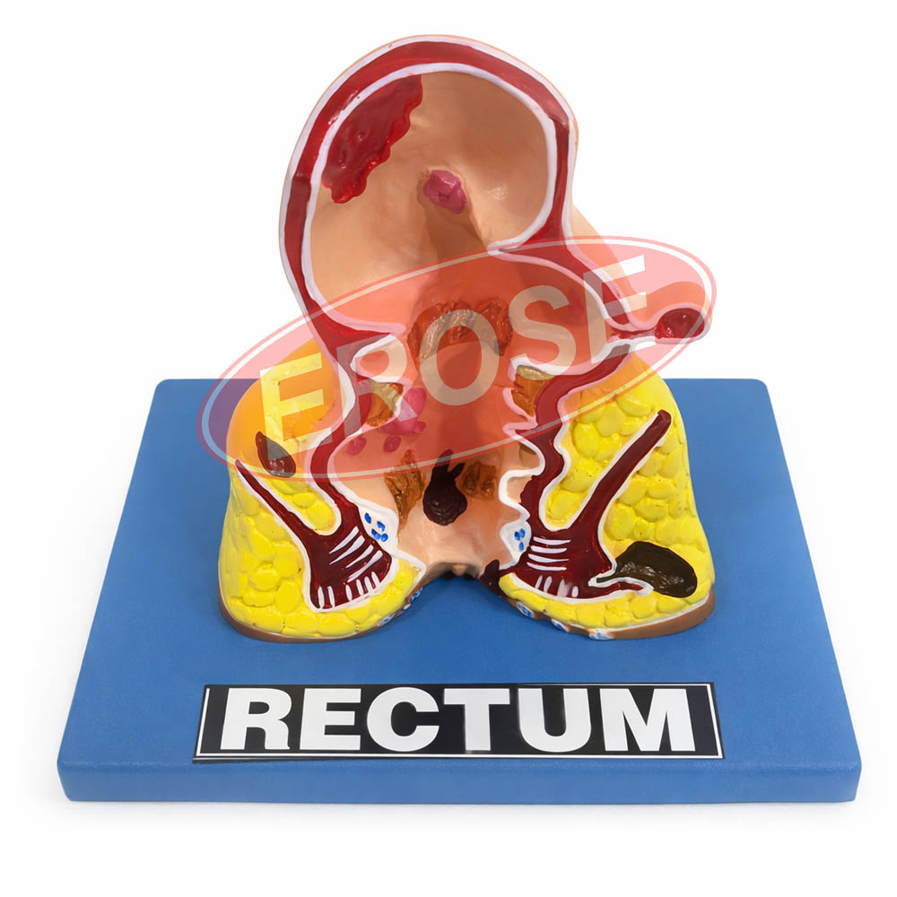 Human Rectum Educational Model