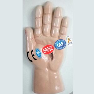 Electric Injury Lesion Of Hand From Current With Live Wire Current 250v, Forensic Model